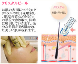 クリスタルピール